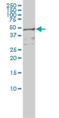 Western Blot: RIOK3 Antibody (4A12-1D2) [H00008780-M01]