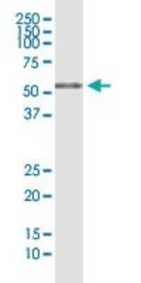 Western Blot: RIOK3 Antibody (4A12-1D2) [H00008780-M01]