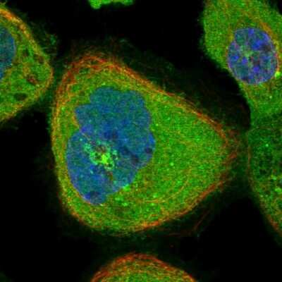 Immunocytochemistry/ Immunofluorescence: RIOK3 Antibody [NBP1-86982]