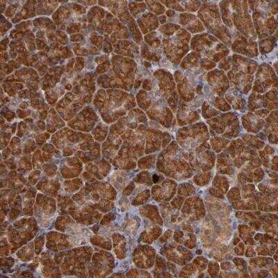 Immunohistochemistry: RIOK3 Antibody [NBP1-86983]