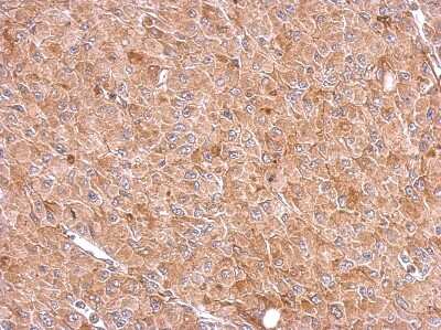 Immunohistochemistry-Paraffin: RIOK3 Antibody [NBP2-20165]