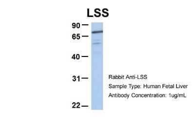 Western Blot: RIOK3 Antibody [NBP1-58215]