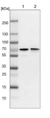 Western Blot: RIOK3 Antibody [NBP1-86982]