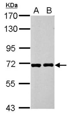 Western Blot: RIOK3 Antibody [NBP2-20165]