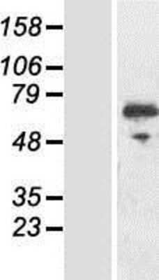 Western Blot: RIOK3 Overexpression Lysate [NBP2-05455]