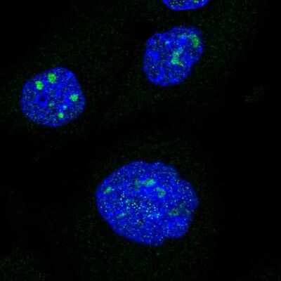 Immunocytochemistry/ Immunofluorescence: RIP140 Antibody [NBP2-57193]