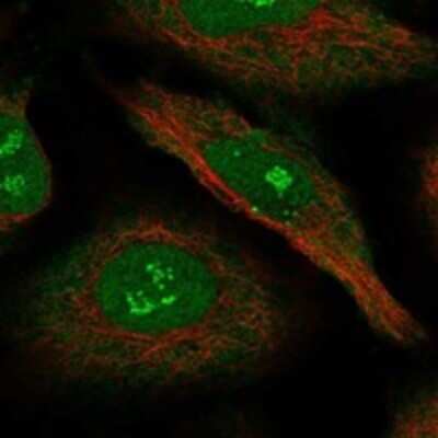 Immunocytochemistry/ Immunofluorescence: RIP140 Antibody [NBP3-17924]