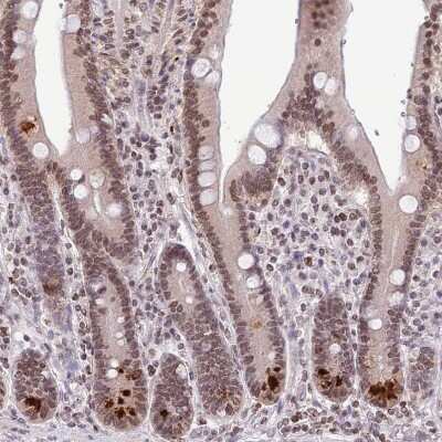 Immunohistochemistry-Paraffin: RIP140 Antibody [NBP2-13674]