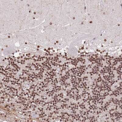 Immunohistochemistry-Paraffin: RIP140 Antibody [NBP2-13674]