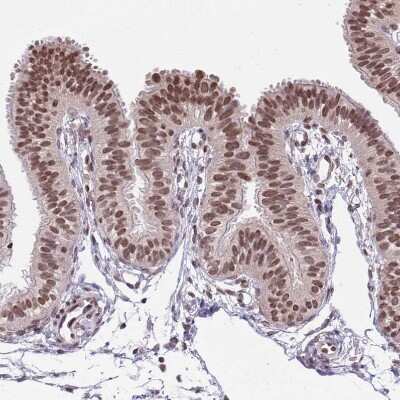 Immunohistochemistry-Paraffin: RIP140 Antibody [NBP2-13674]