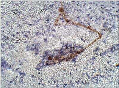 Immunohistochemistry-Paraffin: RIP140 Antibody [NBP3-12264]