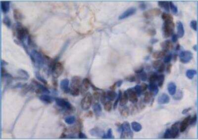 Immunohistochemistry-Paraffin: RIP140 Antibody [NBP3-12264]