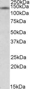 Western Blot: RIP140 Antibody [NBP1-36750]