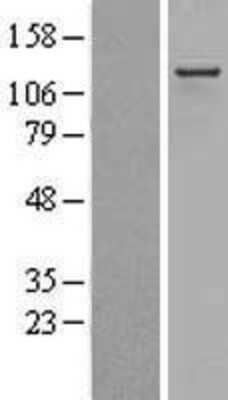 Western Blot: RIP140 Overexpression Lysate [NBL1-13793]