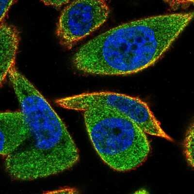 Immunocytochemistry/ Immunofluorescence: RIP5 Antibody [NBP2-33830]