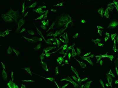 Immunocytochemistry/ Immunofluorescence: RIP5 Antibody [NBP2-99509]