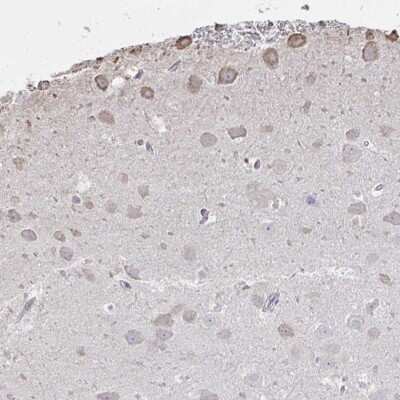 Immunohistochemistry-Paraffin: RIP5 Antibody [NBP2-33830]