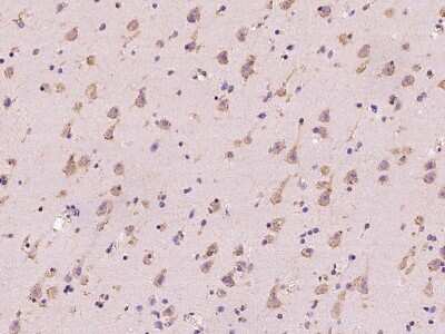 Immunohistochemistry-Paraffin: RIP5 Antibody [NBP2-99509]