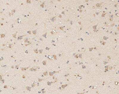 Immunohistochemistry-Paraffin: RIP5 Antibody [NBP3-12785]