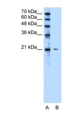 Western Blot: RIP5 Antibody [NBP1-91332]