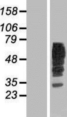 Western Blot: RIP5 Overexpression Lysate [NBP2-06761]