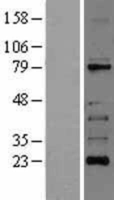 Western Blot: RIPK1/RIP1 Overexpression Lysate [NBL1-15377]