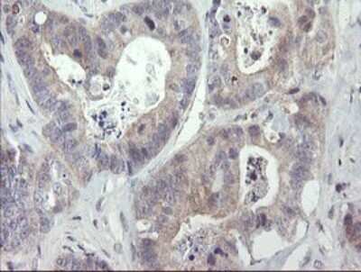 Immunohistochemistry: RIPK1/RIP1 Antibody (OTI2D6) [NBP2-45591]