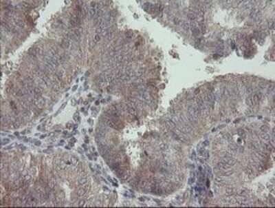 Immunohistochemistry: RIPK1/RIP1 Antibody (OTI2D6) [NBP2-45591]