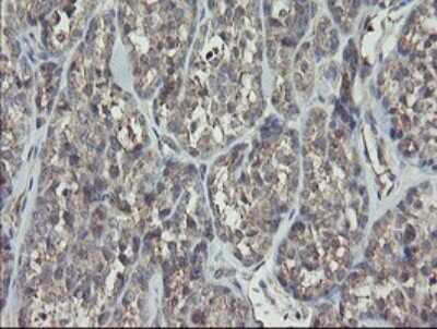 Immunohistochemistry: RIPK1/RIP1 Antibody (OTI2D6) [NBP2-45591]