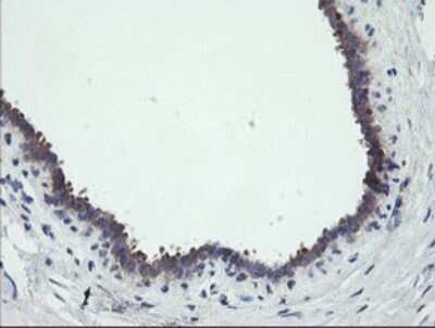 Immunohistochemistry: RIPK1/RIP1 Antibody (OTI2D6) [NBP2-45591]