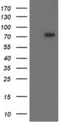 Western Blot: RIPK1/RIP1 Antibody (OTI2D6) [NBP2-45591]