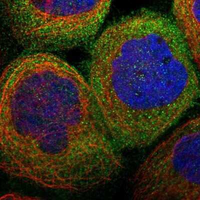 Immunocytochemistry/ Immunofluorescence: RIPK1/RIP1 Antibody [NBP1-87128]