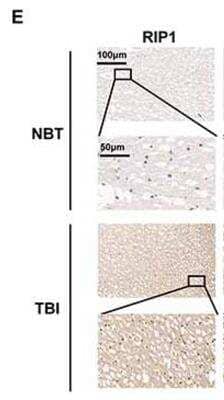 Immunohistochemistry: RIPK1/RIP1 Antibody - BSA Free [NBP1-77077]