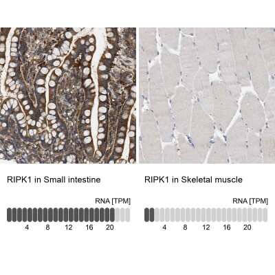 Immunohistochemistry-Paraffin: RIPK1/RIP1 Antibody [NBP1-87128]
