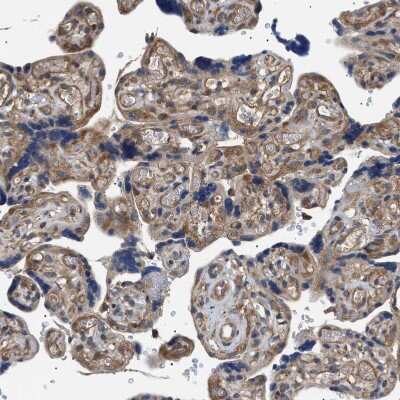 Immunohistochemistry-Paraffin: RIPK1/RIP1 Antibody [NBP1-87128]