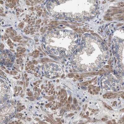 Immunohistochemistry-Paraffin: RIPK1/RIP1 Antibody [NBP1-87128]