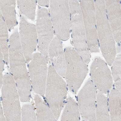 Immunohistochemistry-Paraffin: RIPK1/RIP1 Antibody [NBP1-87128]