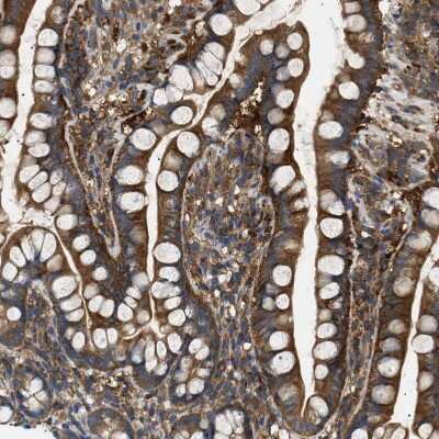 Immunohistochemistry-Paraffin: RIPK1/RIP1 Antibody [NBP1-87128]