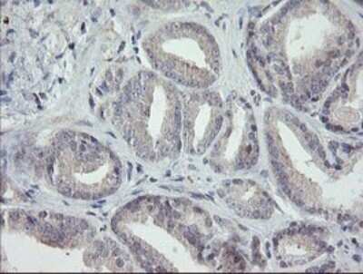 Immunohistochemistry: RIPK1/RIP1 Antibody (OTI2D6) - Azide and BSA Free [NBP2-73911]