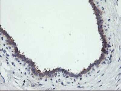 Immunohistochemistry: RIPK1/RIP1 Antibody (OTI2D6) - Azide and BSA Free [NBP2-73911]