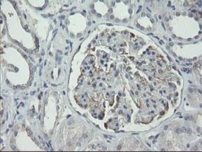 Immunohistochemistry: RIPK1/RIP1 Antibody (OTI2D6) - Azide and BSA Free [NBP2-73911]