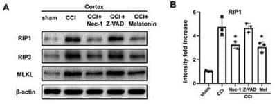 Western Blot: RIPK1/RIP1 AntibodyBSA Free [NBP1-77077]