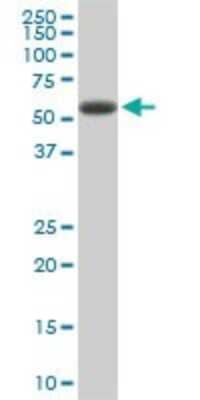 Western Blot: RIPK2 Antibody (2C7) [H00008767-M01]