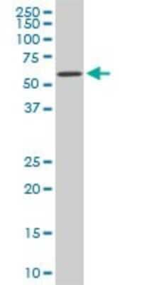 Western Blot: RIPK2 Antibody (2C7) [H00008767-M01]