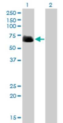 Western Blot: RIPK2 Antibody (2C7) [H00008767-M01]