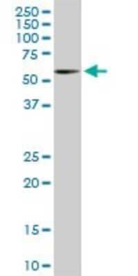 Western Blot: RIPK2 Antibody (6F7) [H00008767-M02]