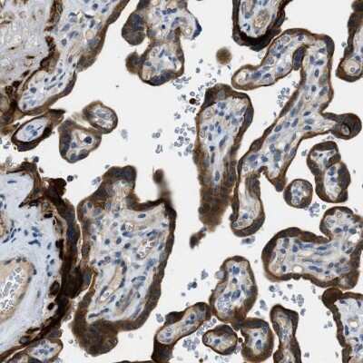 Immunohistochemistry-Paraffin: RIPK2 Antibody [NBP1-86630]