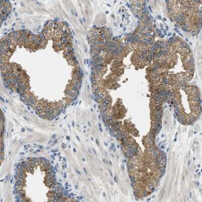 Immunohistochemistry-Paraffin: RIPK2 Antibody [NBP1-86630]