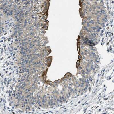 Immunohistochemistry-Paraffin: RIPK2 Antibody [NBP1-86630]
