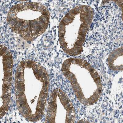 Immunohistochemistry-Paraffin: RIPK2 Antibody [NBP1-86630]